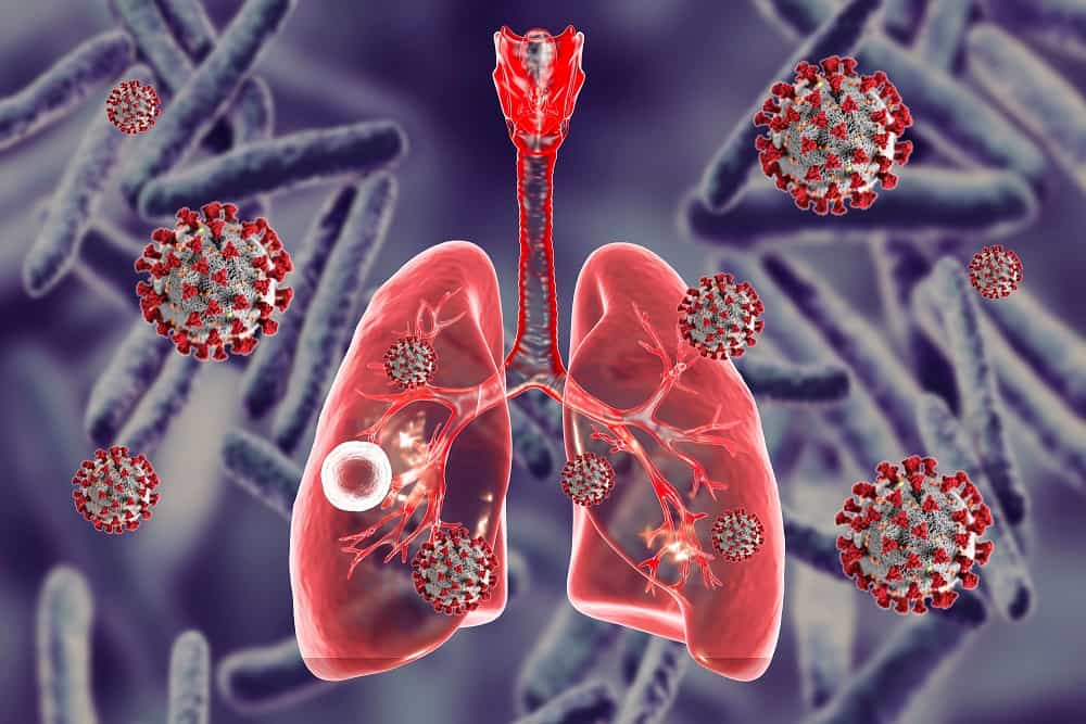 Delta partners media, others to deepen awareness on TB